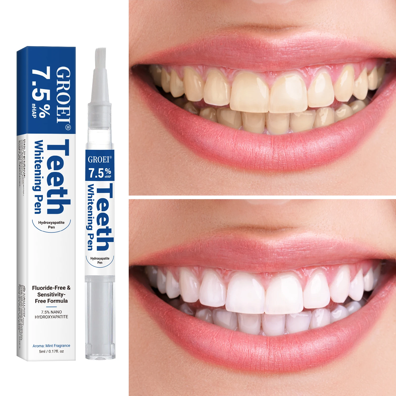 هيدروكسياباتيت تبييض الأسنان ا - مراجعة Teeth Whitening Gel وسعره
