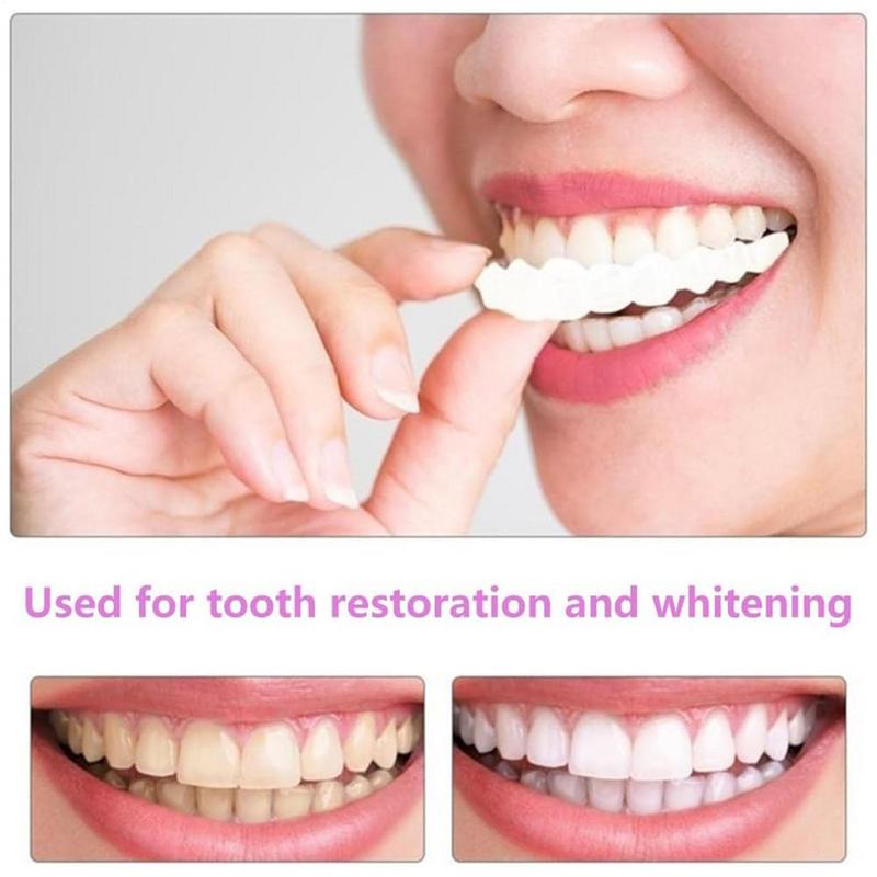 المفاجئة على قشور الأسنان سيلي - مراجعة Teeth Whitening Instant وسعره