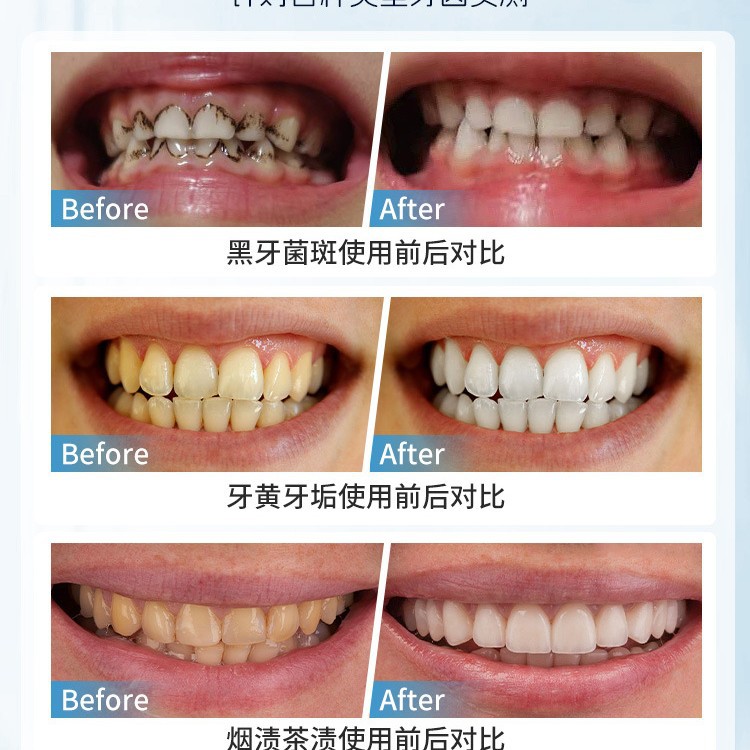 فرشاة يابانية يدوية لإزالة بقع - مراجعة Teeth Whitening In Japan وسعره