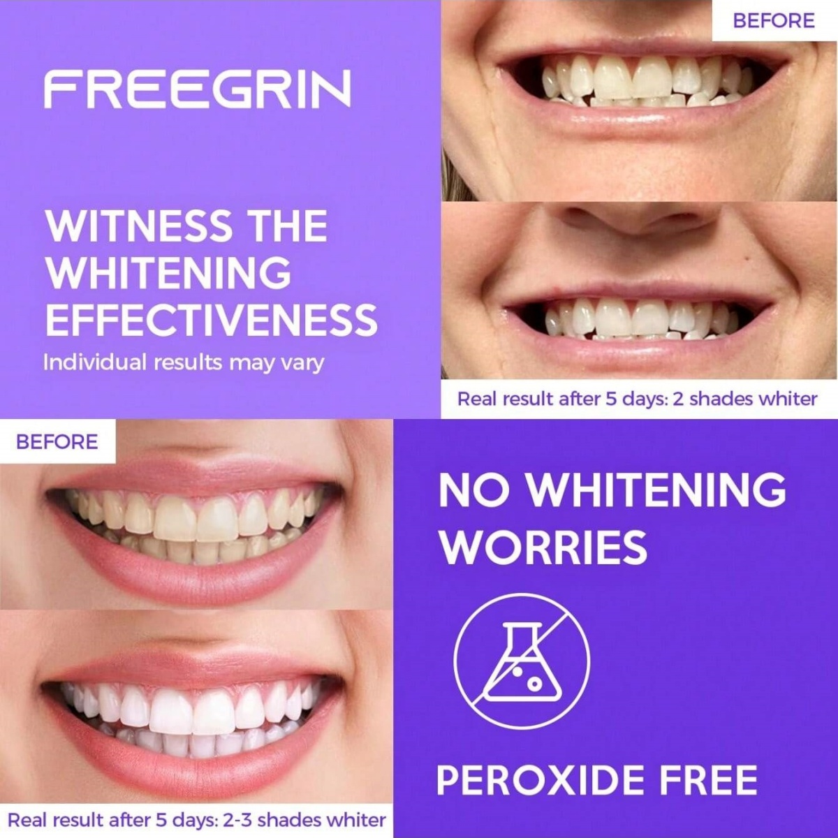 ديلوكس تبييض الأسنان ملصقات 7/ - مراجعة Teeth Whitening Gel Refills وسعره