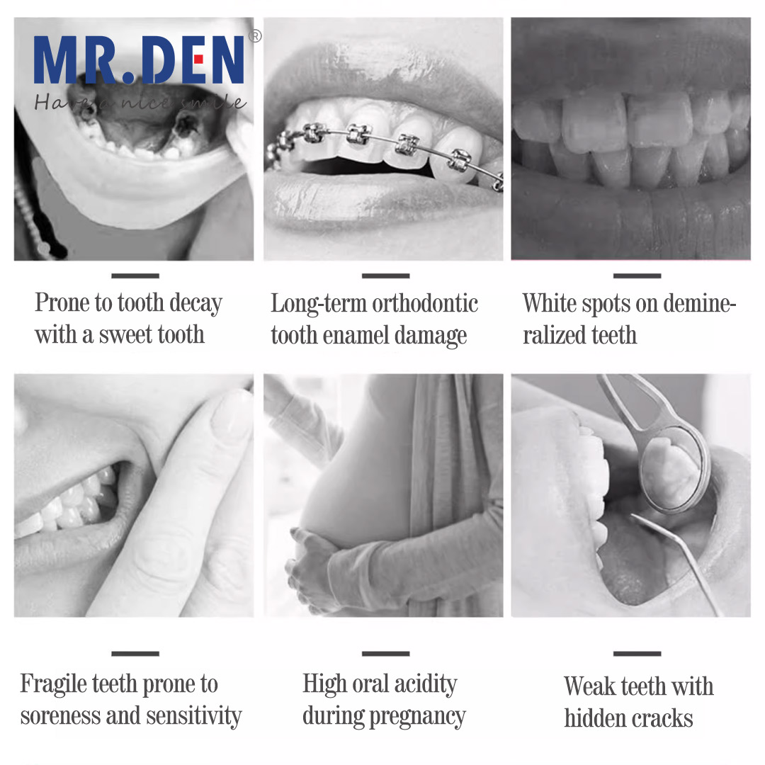 اليابان GC فلوريد تعزيز العناي - مراجعة Teeth Whitening In Japan وسعره